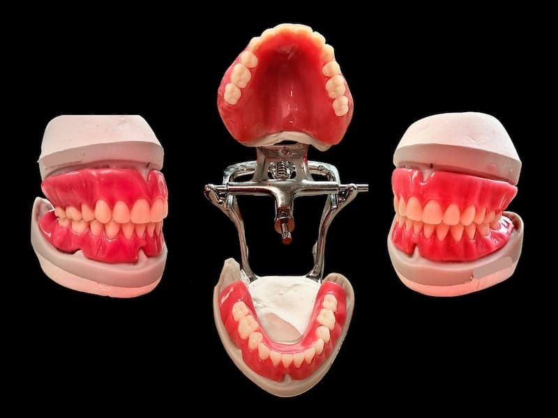 Denture Setup